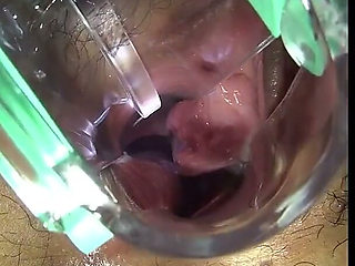 Vaginal Observation Video 1