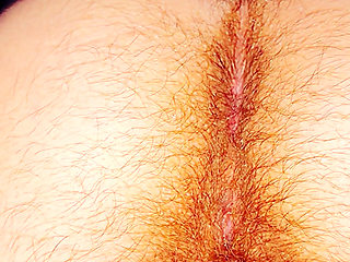 Hairy Butt of a 5-month Pregnant Woman