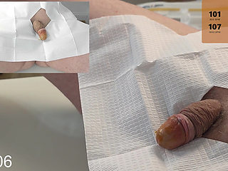 20 French Foley Catheter Insertion