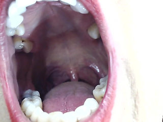 Inside My Big Mouth Tongue Teeth Uvula