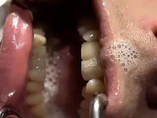 Spit and More Spit! Let Me Just Cover You!