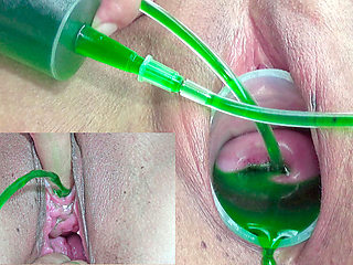 Cervix and Pee Hole Inflation with Injections for Japanese Lesbians