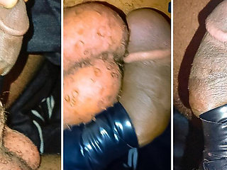 Virginia surgery gone wrong
