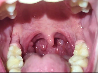A Close-up of My Throat