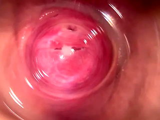 Camera Deep Inside Mia's Vagina