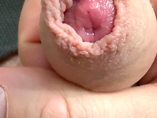 Foreskin. Shows the head of a dick.