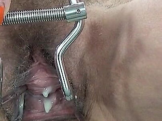 Got Aroused by a Vaginal Dilator