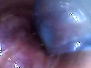 Endoscope POV Test Tube Cock Urethral Insertion