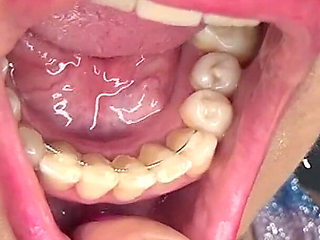 Playing with My Uvula, Tongue and Mouth in Front of a Mirror