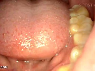 WGGBAATBJRVMLIHKFW31START532