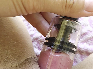 A swollen clitoris looks even fleshier up close