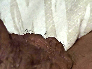 Step son couldn't take care of his erection with broken arm so he asked step mom a handjob