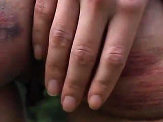 Slave Mila Plays with Her Bruised Caned Bottom Outdoors