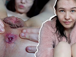 Skinny 18yo German Teen Emmi-Hill Shows Her Tight Body & Big Labia - Petite, Shaved, Homemade
