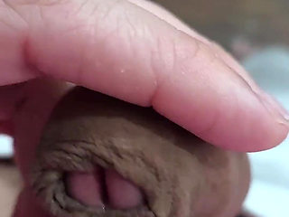 The Head of My Penis
