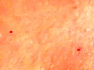 Scandal on the Cruiseship