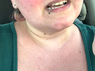 Got a Sunburn for Art Supplies!