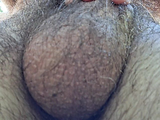 Hairy balls