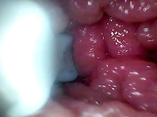 Endoscope Camera Records My Wife's G Spot. Educational Video Close up